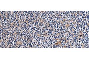 Immunohistochemistry of paraffin-embedded Human tonsil tissue using CEP89 Polyclonal Antibody at dilution of 1:95(x200) (CEP89 Antikörper)