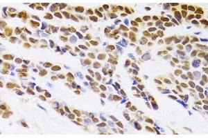 Immunohistochemistry (Paraffin-embedded Sections) (IHC (p)) image for anti-Hepatoma-Derived Growth Factor (HDGF) antibody (ABIN7010580)
