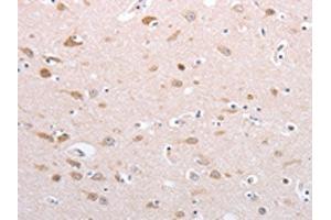 The image on the left is immunohistochemistry of paraffin-embedded Human brain tissue using ABIN7130592(PFN4 Antibody) at dilution 1/20, on the right is treated with fusion protein. (Profilin 4 Antikörper)