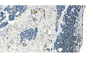 IHC analysis of H Cadherin/CDH13 using anti-H Cadherin/CDH13 antibody (ABIN7600095). (Cadherin 13 Antikörper  (AA 149-692))