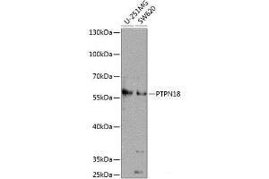 Western blot analysis of extracts of various cell lines using PTPN18 Polyclonal Antibody at dilution of 1:1000. (PTPN18 Antikörper)