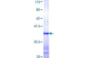 RPL23 Protein (AA 41-140) (GST tag)