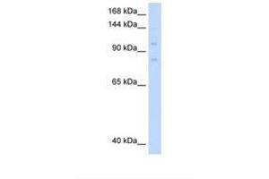 Image no. 2 for anti-Minichromosome Maintenance Deficient 8 (MCM8) (AA 717-766) antibody (ABIN6737804) (MCM8 Antikörper  (AA 717-766))