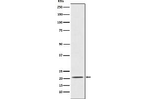 Western blot analysis of Placental Protein 14 / PAEP expression in TPA-treated K562 cell lysate.
