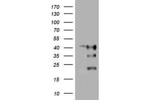 Image no. 1 for anti-Transmembrane Protein 173 (TMEM173) antibody (ABIN1501423) (STING/TMEM173 Antikörper)