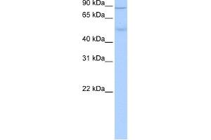 WB Suggested Anti-ALDH1L1 Antibody Titration: 0. (ALDH1L1 Antikörper  (Middle Region))