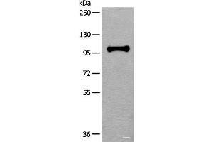 Western blot analysis of HEPG2 cell lysate using HELLS Polyclonal Antibody at dilution of 1:400 (HELLS Antikörper)