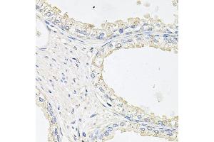 Immunohistochemistry of paraffin-embedded human prostate using EPOR antibody (ABIN5971509) at dilution of 1/100 (40x lens). (EPOR Antikörper)