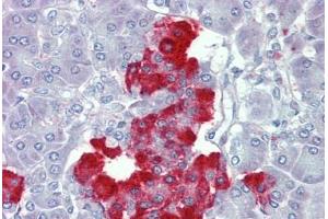 Pancreas, Human: Formalin-Fixed, Paraffin-Embedded (FFPE) (PDGF-BB Homodimer (AA 222-233) Antikörper)