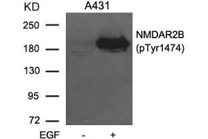 Western blot analysis of extracts from A431 cells untreated or treated with EGF using NMDAR2B (phospho-Tyr1474) Antibody. (GRIN2B Antikörper  (pTyr1474))