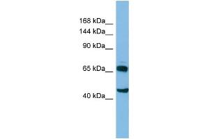 Host: Rabbit Target Name: CLASP2 Sample Type: HT1080 Whole cell lysates Antibody Dilution: 1. (CLASP2 Antikörper  (C-Term))