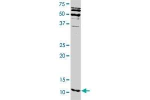 S100A16 polyclonal antibody . (S100A16 Antikörper)