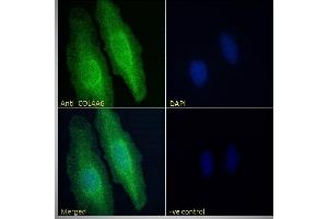 ABIN570771 Immunofluorescence analysis of paraformaldehyde fixed HeLa cells, permeabilized with 0. (COL4a6 Antikörper  (Internal Region))