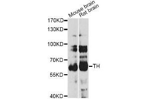Western blot analysis of extracts of various cell lines, using TH antibody (ABIN5974878) at 1/1000 dilution. (TH Antikörper)