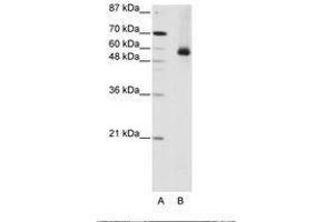 Image no. 2 for anti-Heterogeneous Nuclear Ribonucleoprotein L (HNRNPL) (AA 281-330) antibody (ABIN203218) (HNRNPL Antikörper  (AA 281-330))