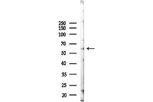 Western blot analysis of lysates from Mouse testis, using ENTPD6 Antibody at 1/1000 dilution.