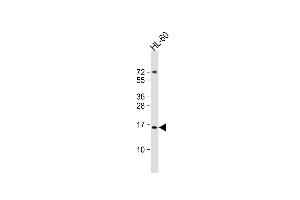 Anti-KISS1 Antibody (C-Term)at 1:2000 dilution + HL-60 whole cell lysates Lysates/proteins at 20 μg per lane. (KISS1 Antikörper  (AA 115-145))