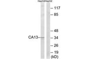 Western blot analysis of extracts from HepG2 cells, using CA13 Antibody. (CA13 Antikörper  (AA 141-190))