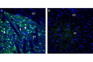 Expression of Neuronal Pentraxin 1 in rat striatum. (Neuronal Pentraxin 1 (NPX1) Peptid)