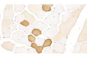 Detection of TNNT1 in Human Skeletal muscle Tissue using Polyclonal Antibody to Troponin T Type 1, Slow Skeletal (TNNT1) (TNNT1 Antikörper  (AA 1-259))