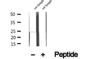 Western blot analysis of extracts of rat lymph tissue, using LAPTM4B antibody. (LAPTM4B Antikörper  (Internal Region))