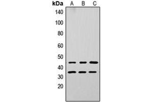 Western blot analysis of Apolipoprotein L3 expression in A549 (A), PC12 (B), NS-1 (C) whole cell lysates. (APOL3 Antikörper  (Center))