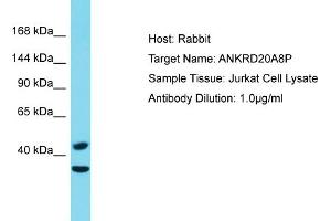 Host: Rabbit Target Name: ANKRD20A8P Sample Type: Jurkat Whole Cell lysates Antibody Dilution: 1.
