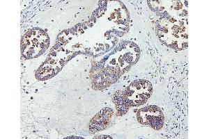 IHC analysis of CETP using anti-CETP antibody (ABIN7602439). (CETP Antikörper  (AA 77-353))