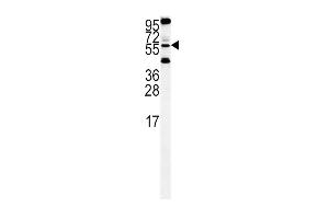 HtrA1- (ABIN388128 and ABIN2846342) western blot analysis in Hela cell line lysates (35 μg/lane). (HTRA1 Antikörper  (C-Term))