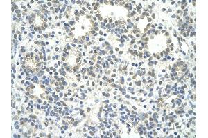 Rabbit Anti-ZNF280D antibody         Paraffin Embedded Tissue:  Human Lung    cell Cellular Data:  alveolar cell    Antibody Concentration:  4. (ZNF280D Antikörper  (N-Term))