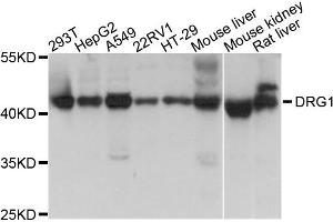 Western blot analysis of extracts of various cell lines, using DRG1 antibody (ABIN1872364) at 1:1000 dilution. (DRG1 Antikörper)