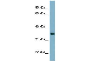 WB Suggested Anti-GEM Antibody Titration:  0. (GEM Antikörper  (N-Term))