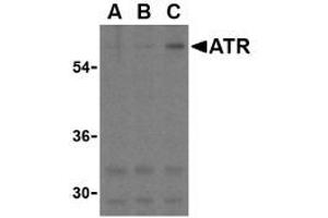Image no. 1 for anti-anthrax Toxin Receptor 1 (ANTXR1) (C-Term) antibody (ABIN205805) (ANTXR1 Antikörper  (C-Term))