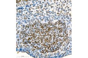 Immunohistochemistry of paraffin embedded mouse ovary using Skar (ABIN7074970) at dilution of 1:900 (400x lens) (p46 Antikörper)