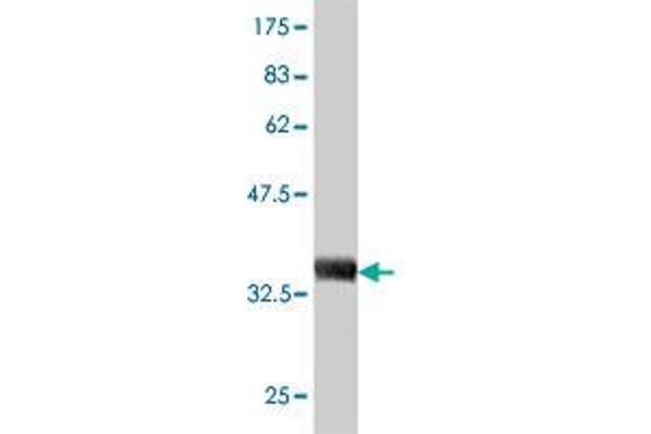 beta-2 Microglobulin Antikörper  (AA 1-119)