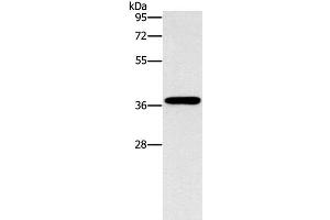 Western Blot analysis of HepG2 cell using MARC1 Polyclonal Antibody at dilution of 1:1400 (MOSC1 Antikörper)
