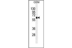 Western blot analysis of DOK3 Antibody (C-term) in CEM cell line lysates (35ug/lane). (DOK3 Antikörper  (C-Term))