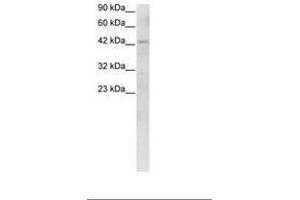Image no. 3 for anti-Recombination Signal Binding Protein For Immunoglobulin kappa J Region (RBPJ) (C-Term) antibody (ABIN6735782) (RBPJ Antikörper  (C-Term))