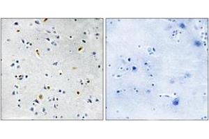 Immunohistochemistry analysis of paraffin-embedded human brain tissue, using DIL-2 Antibody. (TPX2 Antikörper  (AA 301-350))
