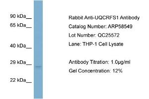 WB Suggested Anti-UQCRFS1  Antibody Titration: 0. (UQCRFS1 Antikörper  (N-Term))