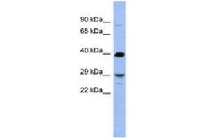 Image no. 1 for anti-Oligodendrocyte Transcription Factor 3 (OLIG3) (N-Term) antibody (ABIN6742934) (OLIG3 Antikörper  (N-Term))