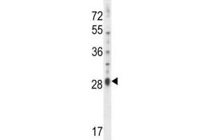 IL17D antibody western blot analysis in NCI-H460 lysate. (IL17D Antikörper  (AA 155-183))