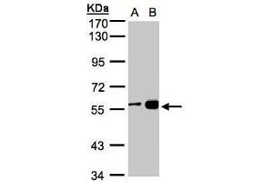 RCC2 anticorps