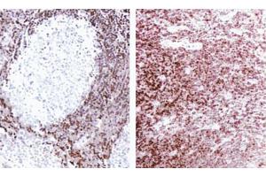Formalin-fixed, paraffin-embedded tissue sections stained for Bcl-2 expression using clone Bcl-2/100 and the SA-HRP method. (Bcl-2 Antikörper  (AA 41-54))