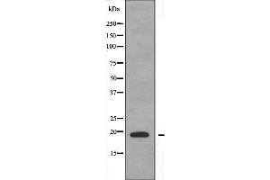 Western blot analysis of extracts from COLO205 cells, using TNFSF15 antibody. (TNFSF15 Antikörper  (C-Term))