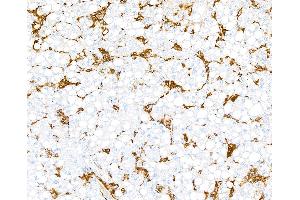 Immunohistochemistry (IHC) image for anti-MHC Class II HLA-DP/DQ/DR (HLA-DP/DQ/DR) antibody (ABIN7449429) (MHC Class II HLA-DP/DQ/DR Antikörper)