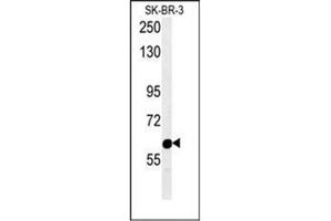 Western blot analysis of RADIL Antibody (C-term) in SK-BR-3 cell line lysates (15ug/lane).