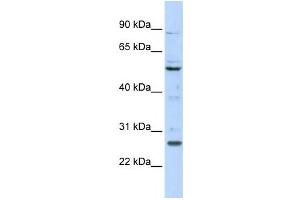 Western Blotting (WB) image for anti-Homeobox C5 (HOXC5) antibody (ABIN2458390) (Homeobox C5 Antikörper)