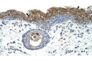 EIF2A antibody was used for immunohistochemistry at a concentration of 4-8 ug/ml to stain Epidermal cells (arrows) in Human Skin. (EIF2A Antikörper  (C-Term))