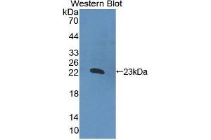 Western Blotting (WB) image for anti-Interleukin 2 (IL2) (AA 1-142) antibody (ABIN3201181) (IL-2 Antikörper  (AA 1-142))